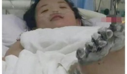 爆料女孩截肢视频大全